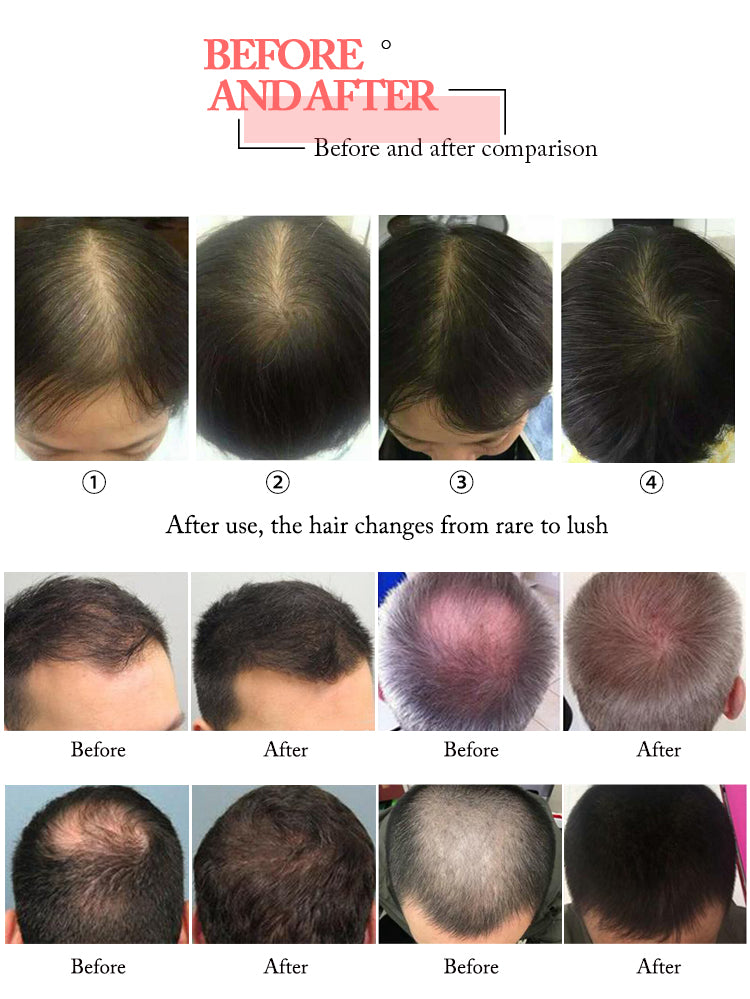 HR68 Laser Hair Growth Machine